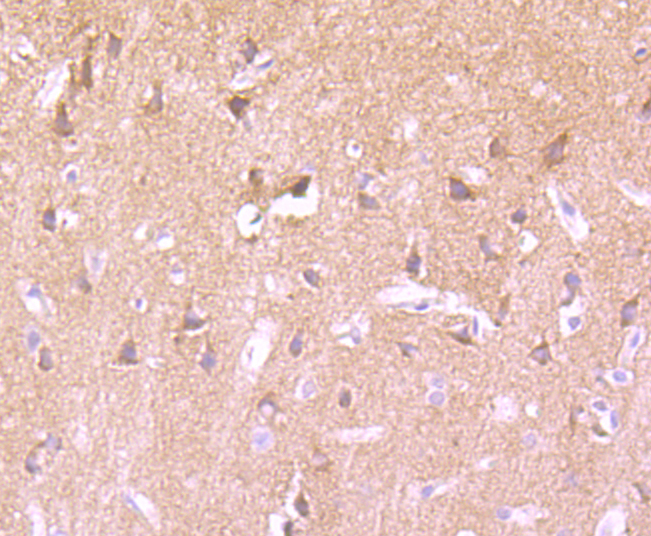 Phospho-PKC alpha (T638) Rabbit mAb