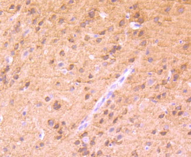 Phospho-PKC alpha (T638) Rabbit mAb