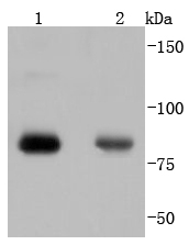 Phospho-PKC alpha (T638) Rabbit mAb