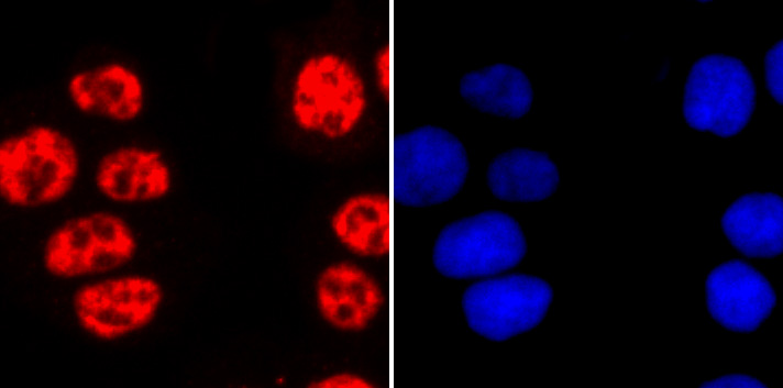 Phospho-POLR2A (S2) Rabbit mAb