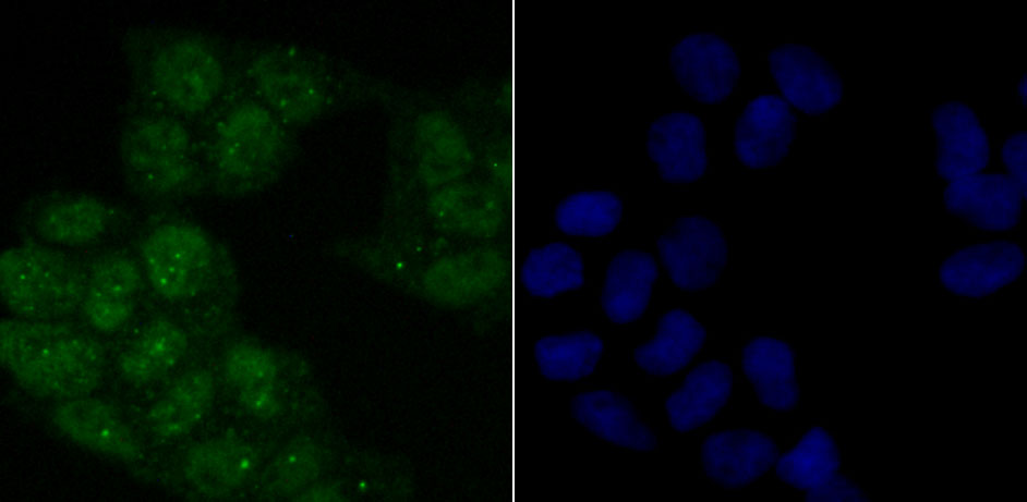 ATM (phospho S1981) Rabbit mAb