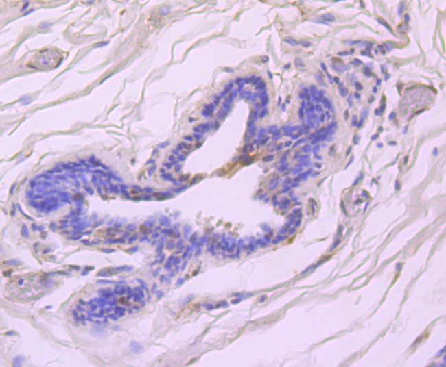 ATM (phospho S1981) Rabbit mAb