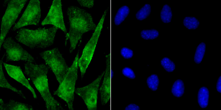 Phospho-alpha Synuclein (S129) Rabbit mAb