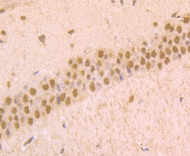 Phospho-alpha Synuclein (S129) Rabbit mAb