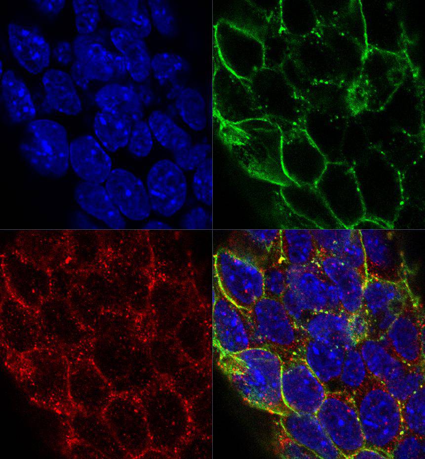 Autoimmune regulator Antibody