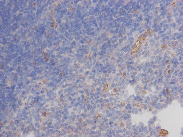 Autoimmune regulator Antibody