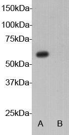 Autoimmune regulator Antibody