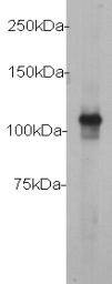 C-myc HRP Antibody