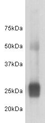 Human Iambda light chain Antibody