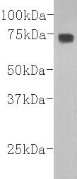 Complement C3β- chain Antibody