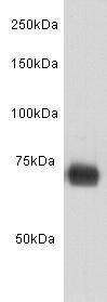 Human  Serum Albumin Antibody