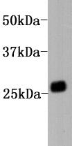 Human IgG kapa light chain Antibody