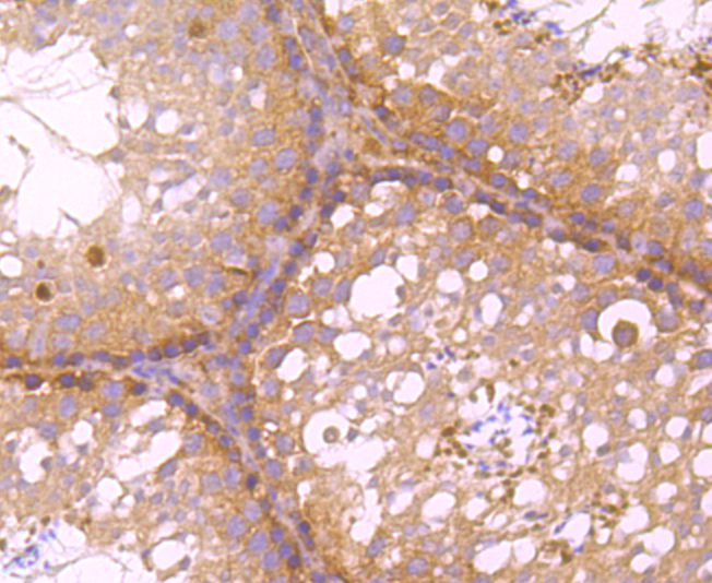 C12orf51 Antibody