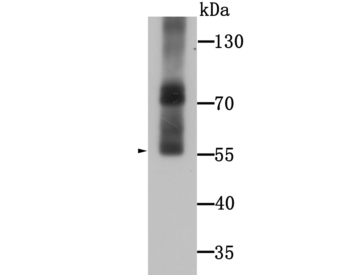 WSCD2 Antibody