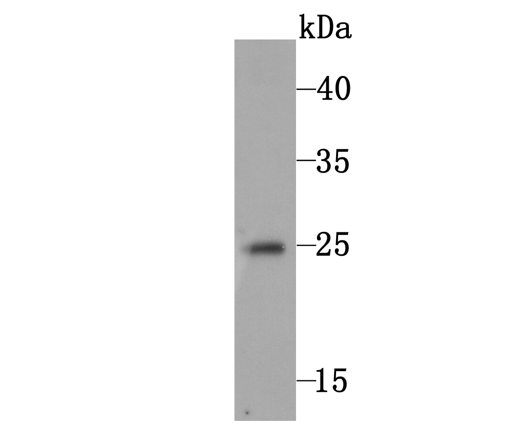 C10orf58 Antibody