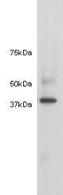 Alpha-cardiac actin Antibody