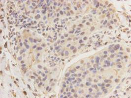 Breast cancer-overexpressed gene 1 protein Antibody