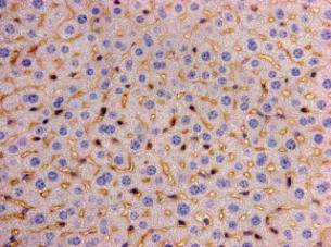 LRP-1 Antibody