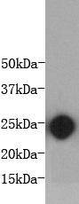 Interleukin 6 Antibody