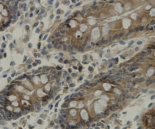 TMEM177 Antibody