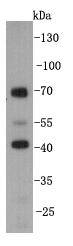 KLHDC3 Antibody