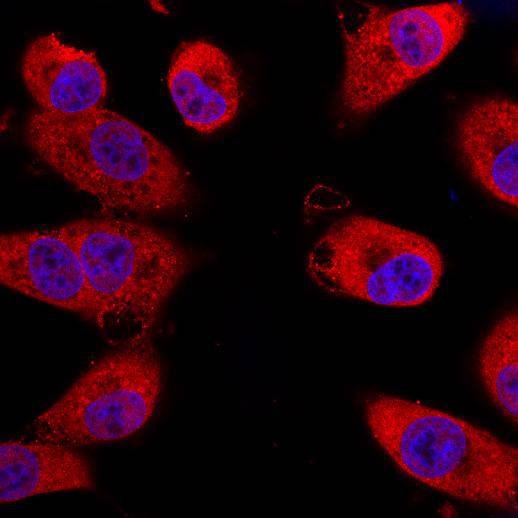 Alpha smooth muscle Actin Antibody