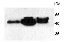 Alpha smooth muscle Actin Antibody