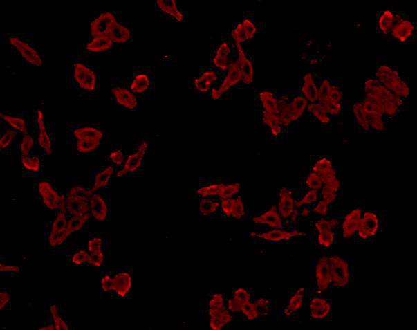 Cathepsin B Antibody