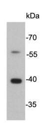 Cathepsin B Antibody