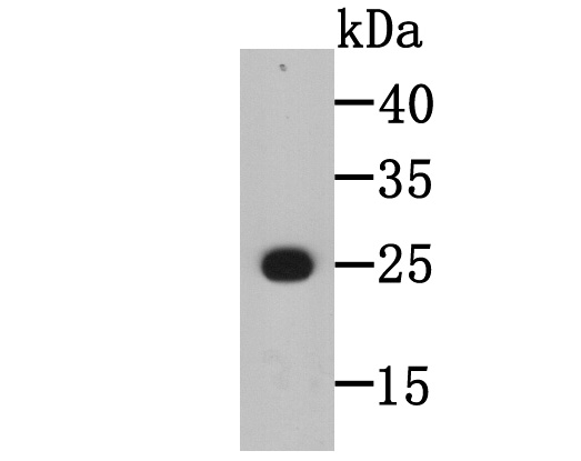 BLCAP Antibody