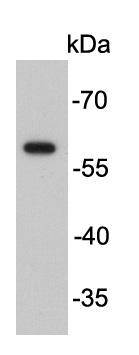 Restriction enzyme FokI(Internal) Antibody