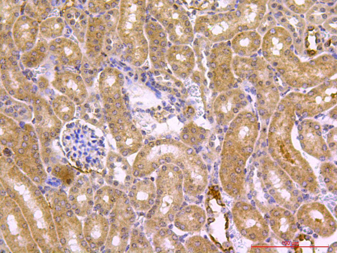 Beclin 1 Antibody