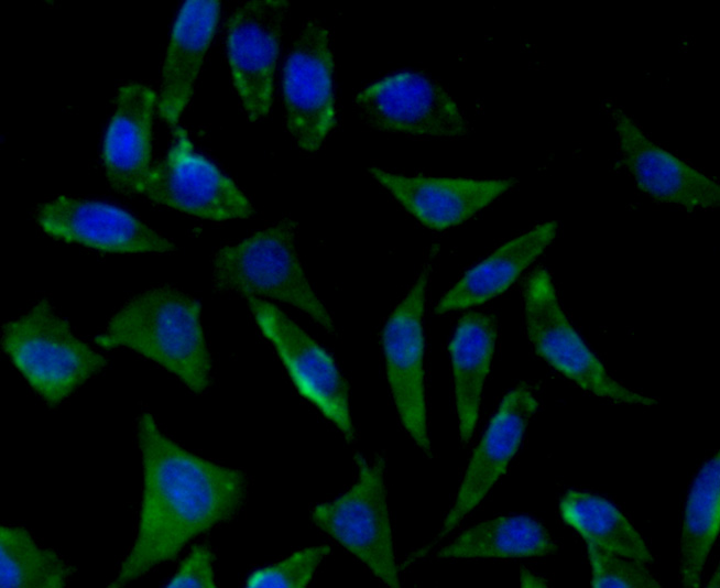 Peroxiredoxin 2/PRDX2 Antibody