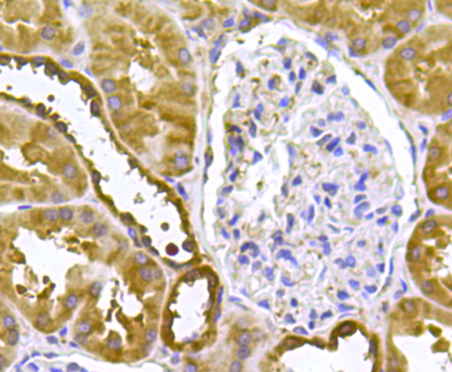 Peroxiredoxin 2/PRDX2 Antibody