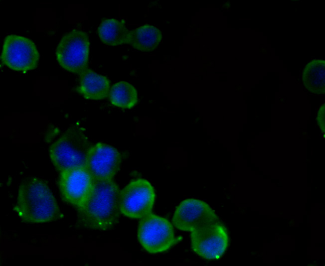 Metadherin(LYRIC) Antibody