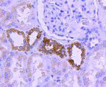 NADPH oxidase 4 Antibody