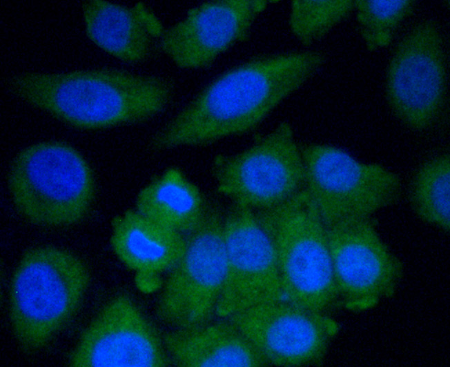 Cytochrome P450 2E1 Antibody