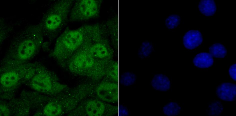 Histone Deacetylase 2 Antibody