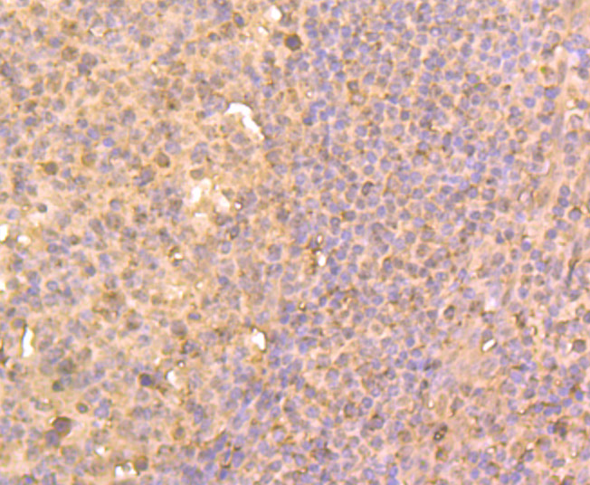 Histone Deacetylase 2 Antibody