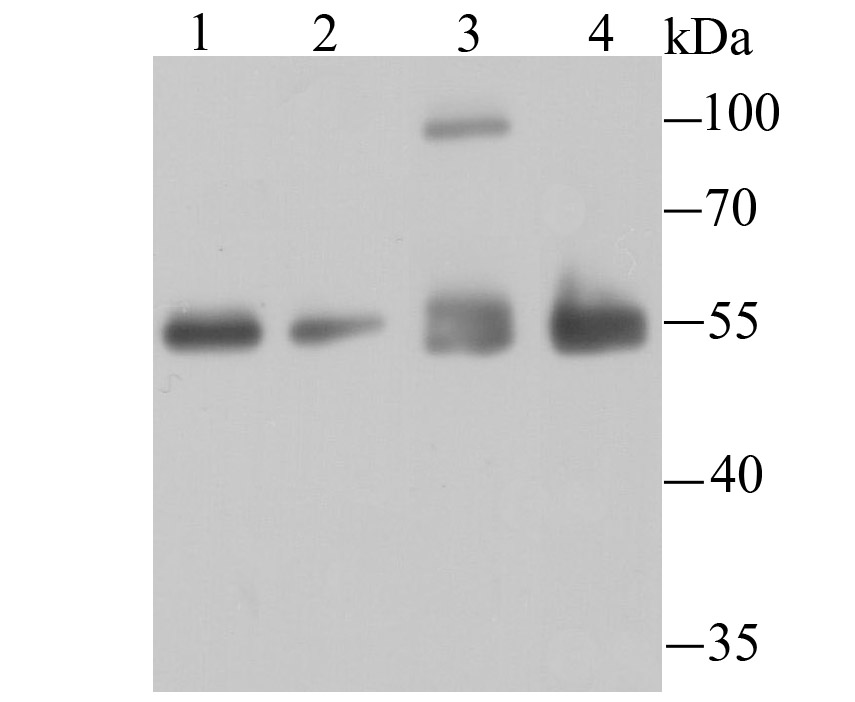 Histone Deacetylase 2 Antibody