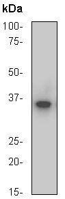 IkappaB alpha Antibody