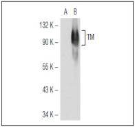 CD141 Antibody