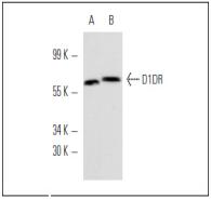 D(1A) dopamine recepr (DRD1) Antibody