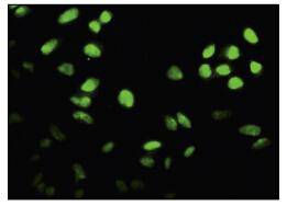 FOXF2 Antibody