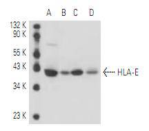 HLA E Antibody