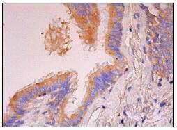 MKP-3 Antibody