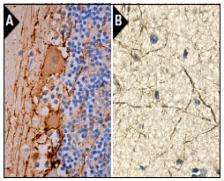 NF-H Antibody