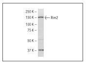 RIM 2 Antibody