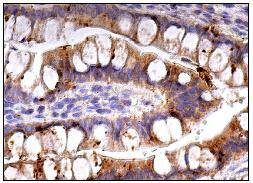 TNFR1 Antibody