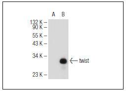 Twist Antibody